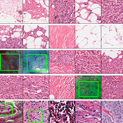 Pathology Foundation Models